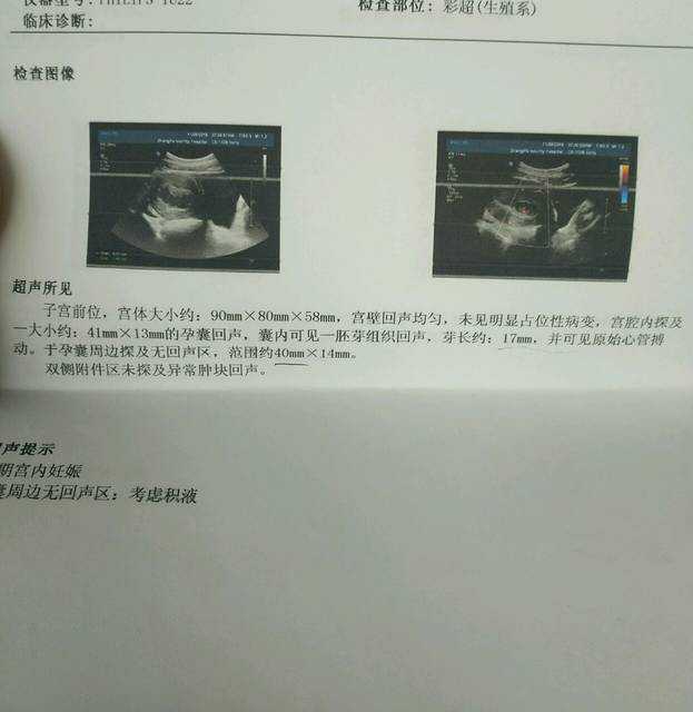 试管生男孩费用多少&苏州供卵多少钱,              苏州市相城区中医医院看多囊卵巢找哪个医生好？            