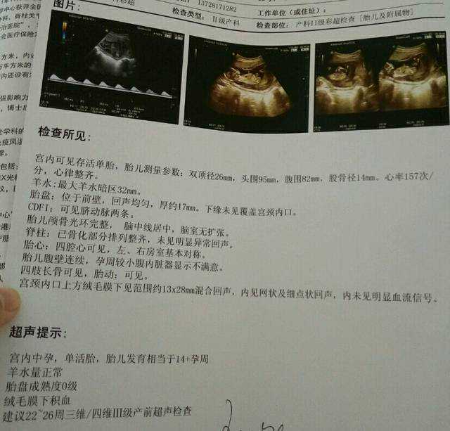 河南省人民医院生殖中心人工授精成功率解析与代生助孕参考